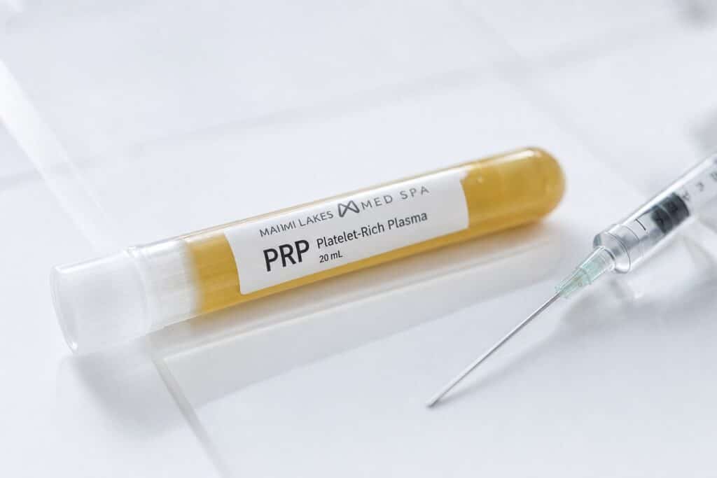 PRP centrifuge tube and syringe macro detail showing platelet-rich plasma cost components at Miami Lakes Med Spa