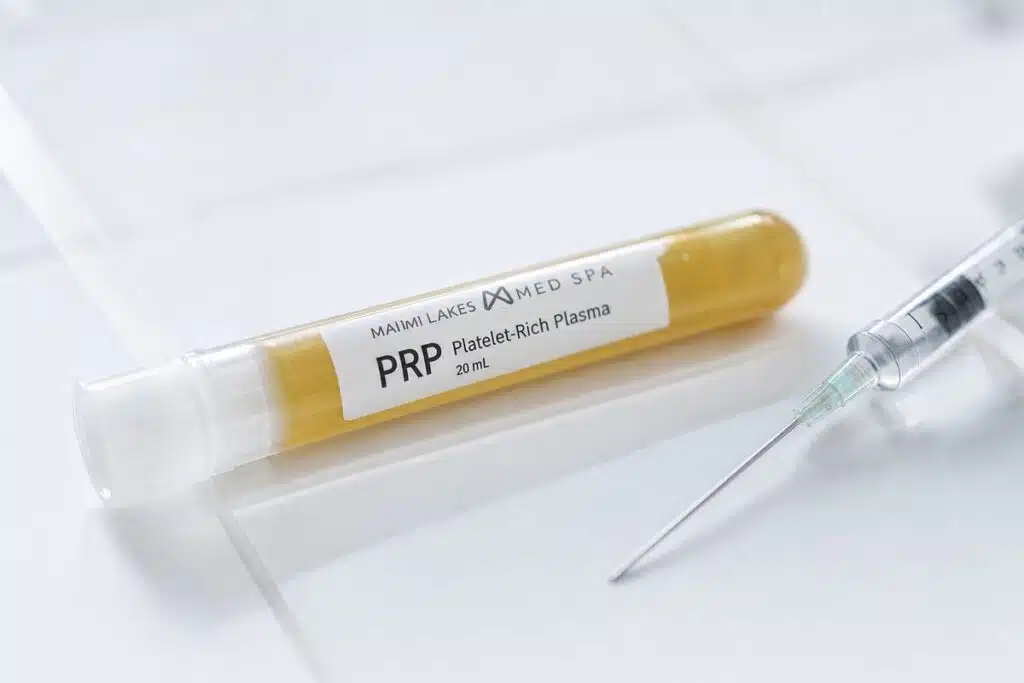 PRP centrifuge tube and syringe macro detail showing platelet-rich plasma cost components at Miami Lakes Med Spa