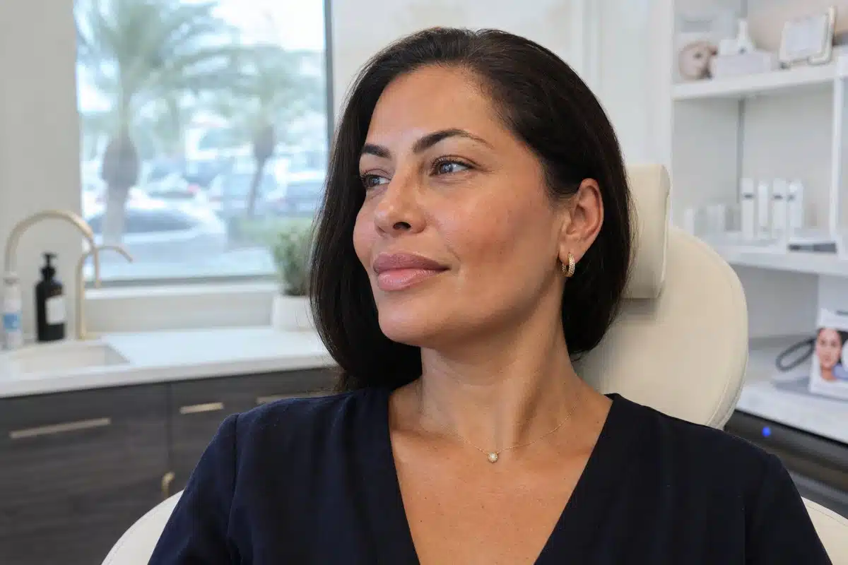 Close-up of a Latina woman's lips and cheeks showing natural dermal filler results
