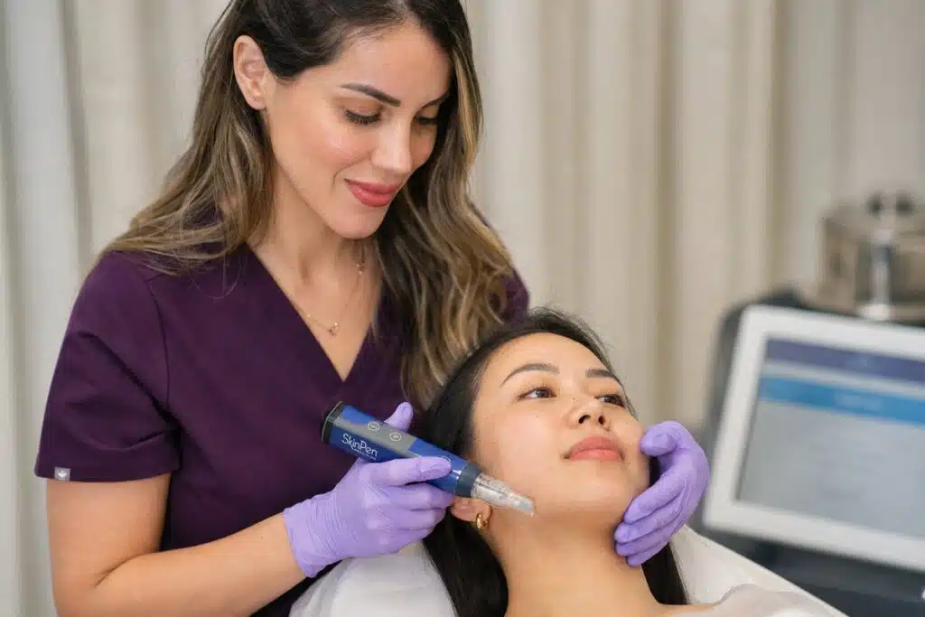 Clinician performing SkinPen microneedling on a patient's cheek at Miami Lakes Med Spa